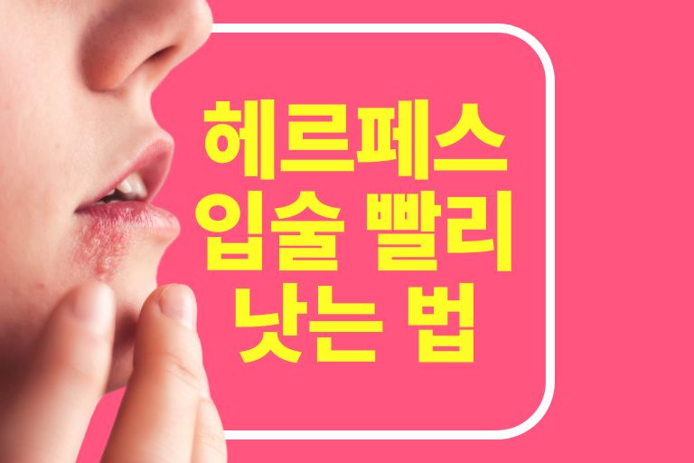헤르페스 입술 빨리 낫는 법 (포진, 구내염) 예방법 - 렛츠쿡푸드
