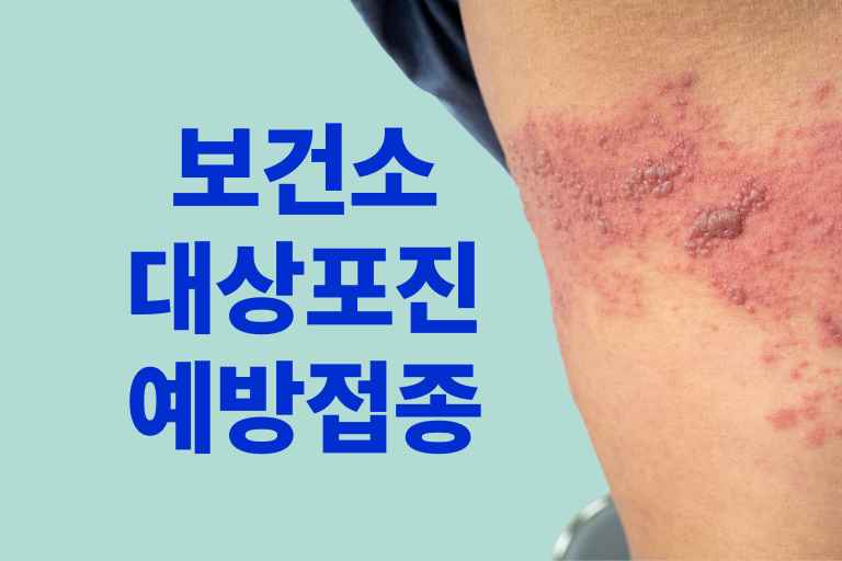 보건소 대상포진 예방접종 가격