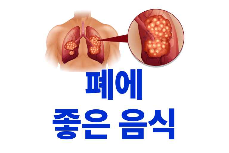 폐에 좋은 음식